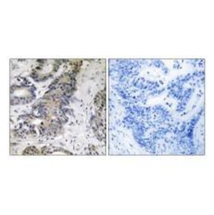 Immunohistochemistry - 4E-BP1 Antibody from Signalway Antibody (33269) - Antibodies.com