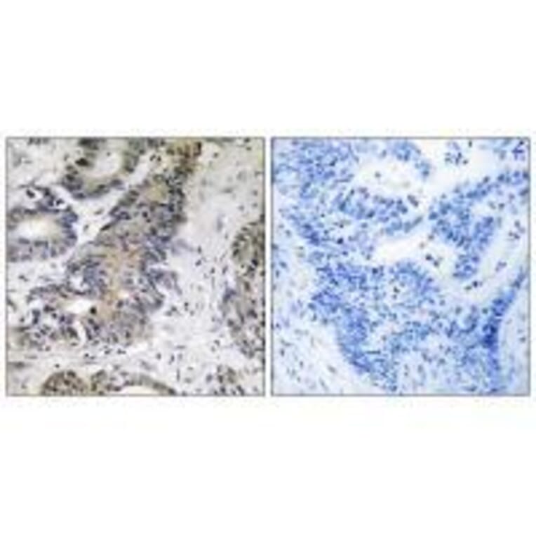 Immunohistochemistry - 4E-BP1 Antibody from Signalway Antibody (33269) - Antibodies.com