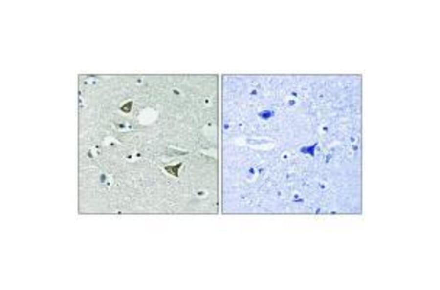 Immunohistochemistry - Girdin Antibody from Signalway Antibody (33285) - Antibodies.com