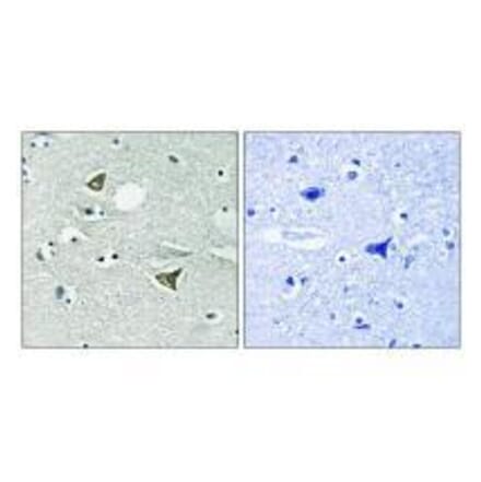 Immunohistochemistry - Girdin Antibody from Signalway Antibody (33285) - Antibodies.com