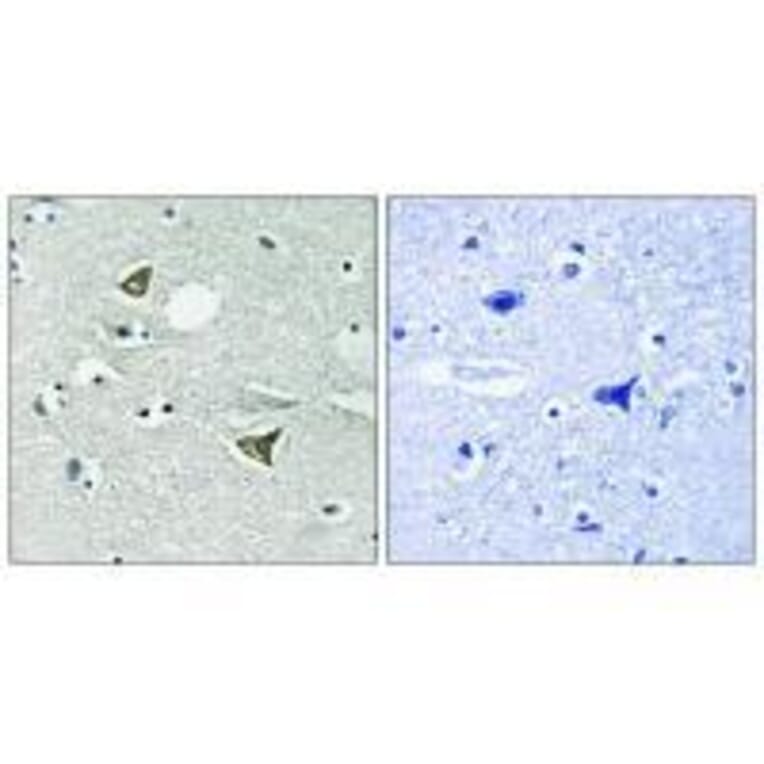 Immunohistochemistry - Girdin Antibody from Signalway Antibody (33285) - Antibodies.com