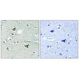 Immunohistochemistry - Girdin Antibody from Signalway Antibody (33285) - Antibodies.com