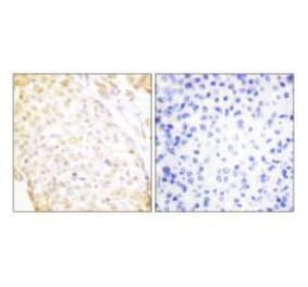 Immunohistochemistry - NKX3.1 Antibody from Signalway Antibody (33448) - Antibodies.com