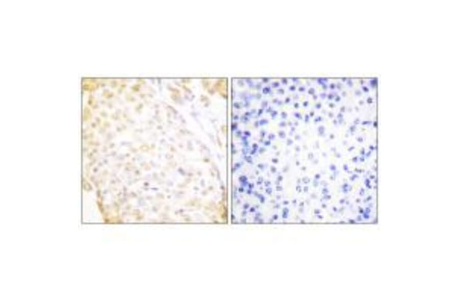 Immunohistochemistry - NKX3.1 Antibody from Signalway Antibody (33448) - Antibodies.com