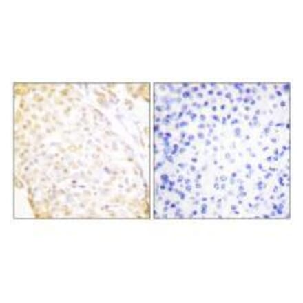Immunohistochemistry - NKX3.1 Antibody from Signalway Antibody (33448) - Antibodies.com
