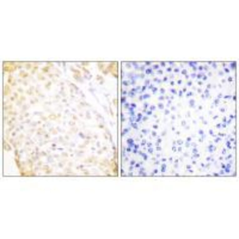 Immunohistochemistry - NKX3.1 Antibody from Signalway Antibody (33448) - Antibodies.com
