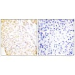 Immunohistochemistry - NKX3.1 Antibody from Signalway Antibody (33448) - Antibodies.com