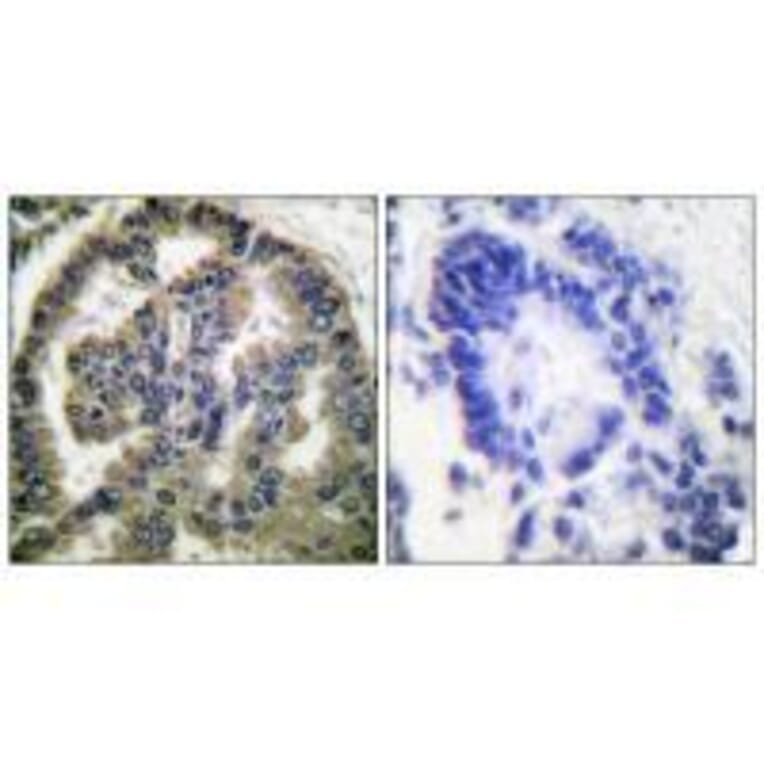 Immunohistochemistry - TGF β2 Antibody from Signalway Antibody (33497) - Antibodies.com