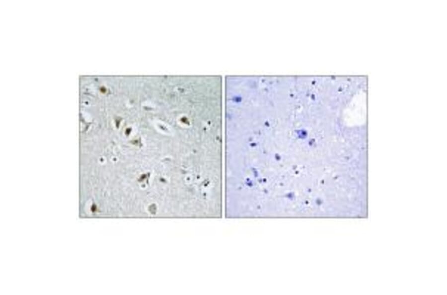 Immunohistochemistry - CDKA2 Antibody from Signalway Antibody (33620) - Antibodies.com