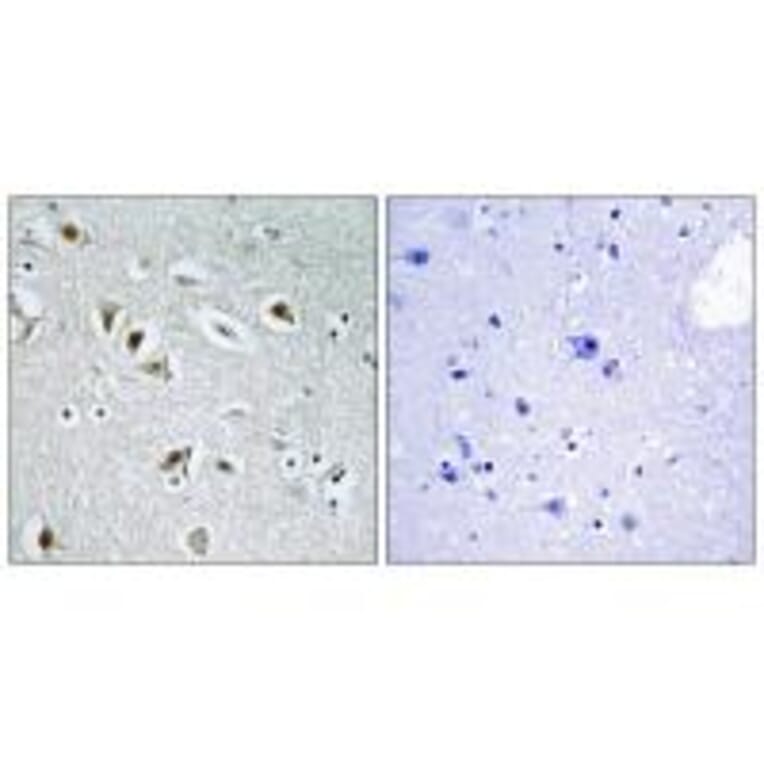 Immunohistochemistry - CDKA2 Antibody from Signalway Antibody (33620) - Antibodies.com