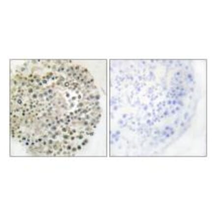Immunohistochemistry - TRIM16 Antibody from Signalway Antibody (33630) - Antibodies.com