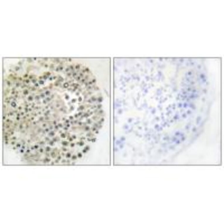 Immunohistochemistry - TRIM16 Antibody from Signalway Antibody (33630) - Antibodies.com