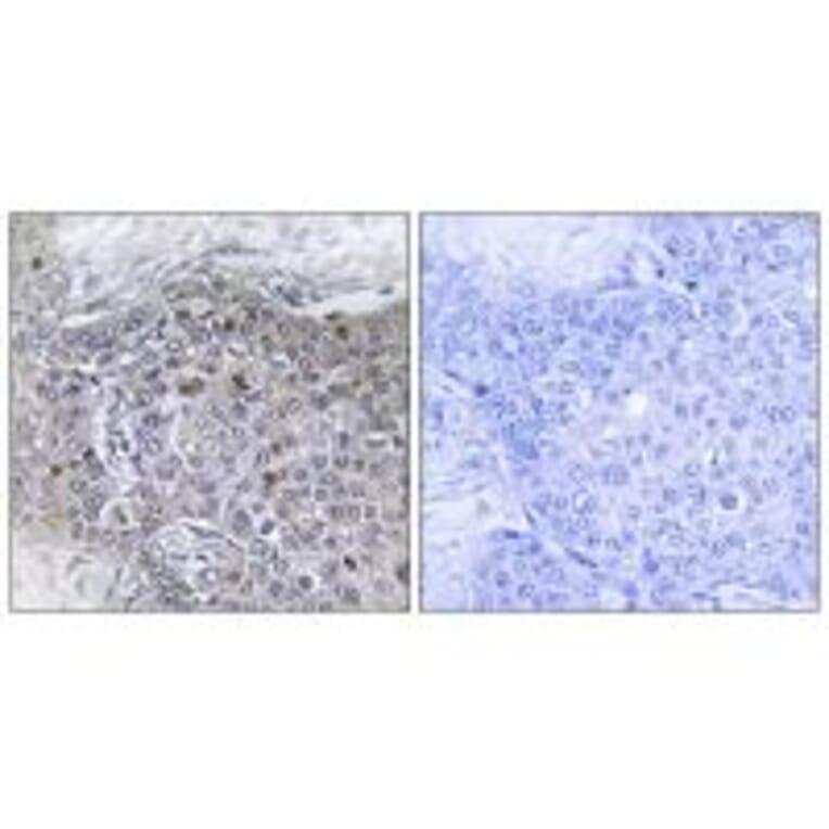 Immunohistochemistry - ZMY11 Antibody from Signalway Antibody (33894) - Antibodies.com