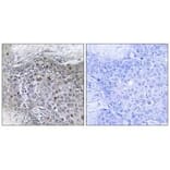 Immunohistochemistry - ZMY11 Antibody from Signalway Antibody (33894) - Antibodies.com
