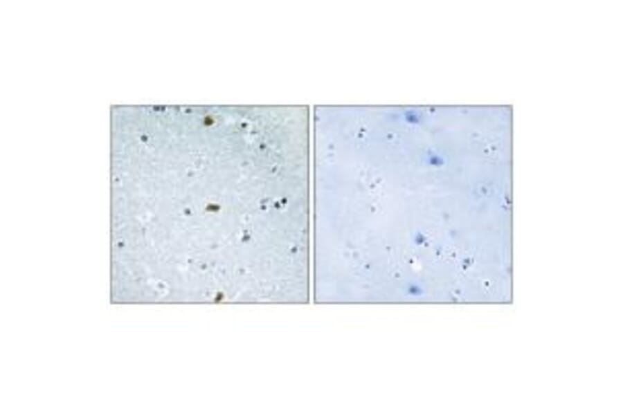 Immunohistochemistry - ZFHX3 Antibody from Signalway Antibody (33910) - Antibodies.com
