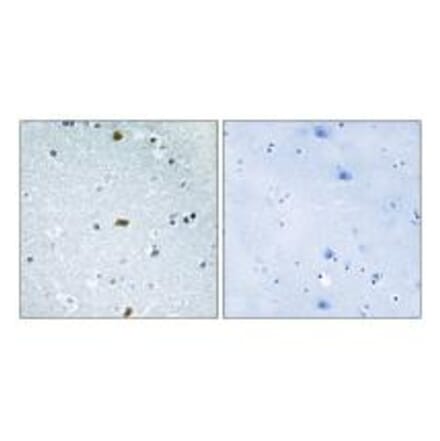 Immunohistochemistry - ZFHX3 Antibody from Signalway Antibody (33910) - Antibodies.com