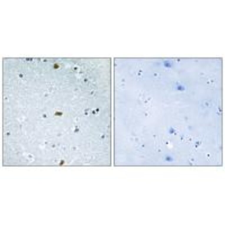 Immunohistochemistry - ZFHX3 Antibody from Signalway Antibody (33910) - Antibodies.com