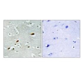 Immunohistochemistry - TIP60 Antibody from Signalway Antibody (34012) - Antibodies.com