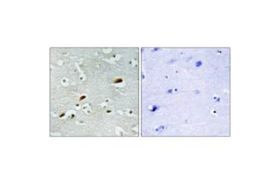 Immunohistochemistry - TIP60 Antibody from Signalway Antibody (34012) - Antibodies.com