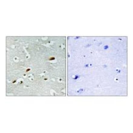 Immunohistochemistry - TIP60 Antibody from Signalway Antibody (34012) - Antibodies.com