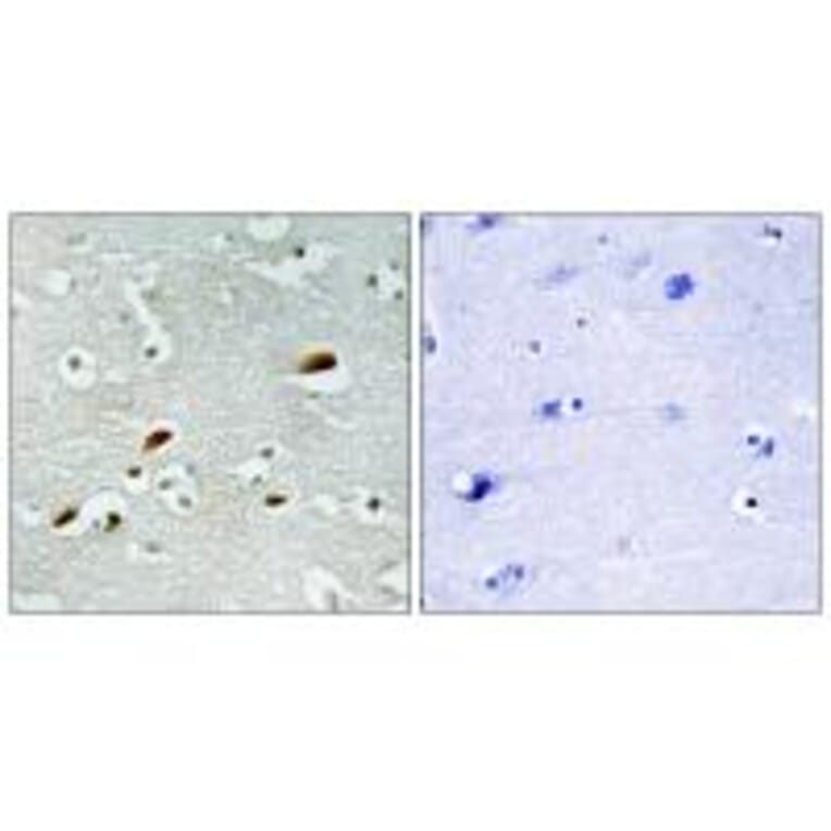 Immunohistochemistry - TIP60 Antibody from Signalway Antibody (34012) - Antibodies.com