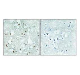 Immunohistochemistry - ELAC2 Antibody from Signalway Antibody (34041) - Antibodies.com