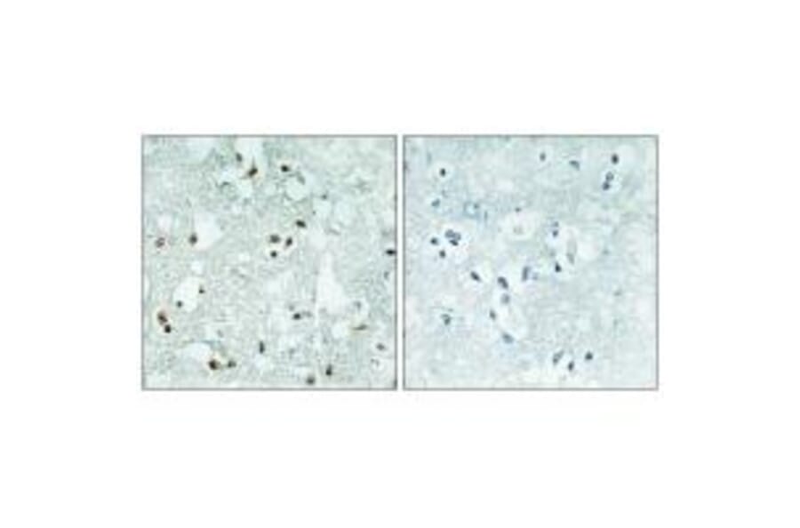 Immunohistochemistry - ELAC2 Antibody from Signalway Antibody (34041) - Antibodies.com