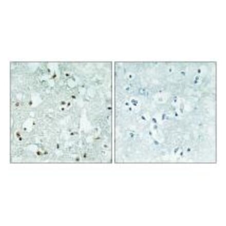 Immunohistochemistry - ELAC2 Antibody from Signalway Antibody (34041) - Antibodies.com