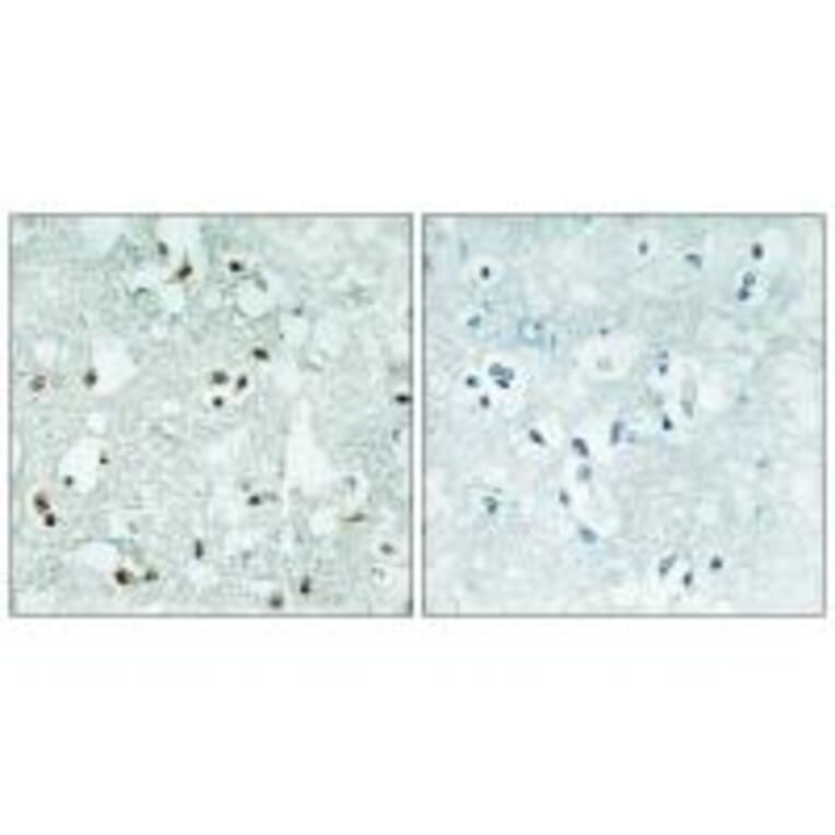 Immunohistochemistry - ELAC2 Antibody from Signalway Antibody (34041) - Antibodies.com