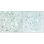 Immunohistochemistry - ELAC2 Antibody from Signalway Antibody (34041) - Antibodies.com