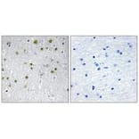 Immunohistochemistry - NRIP2 Antibody from Signalway Antibody (34042) - Antibodies.com
