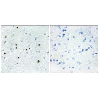 Immunohistochemistry analysis of paraffin-embedded human brain tissue, using DCLK3 antibody #34055.