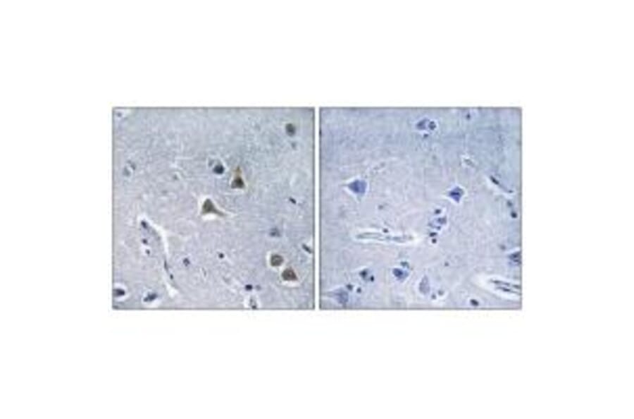 Immunohistochemistry - ARRDC2 Antibody from Signalway Antibody (34168) - Antibodies.com