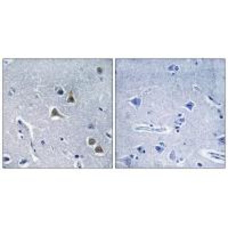 Immunohistochemistry - ARRDC2 Antibody from Signalway Antibody (34168) - Antibodies.com