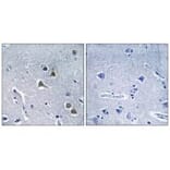 Immunohistochemistry - ARRDC2 Antibody from Signalway Antibody (34168) - Antibodies.com