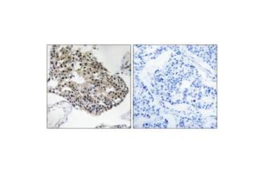 Immunohistochemistry - RPS25 Antibody from Signalway Antibody (34337) - Antibodies.com