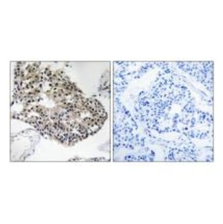 Immunohistochemistry - RPS25 Antibody from Signalway Antibody (34337) - Antibodies.com