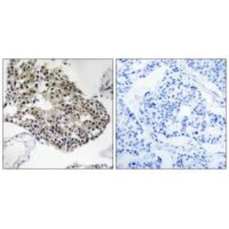 Immunohistochemistry - RPS25 Antibody from Signalway Antibody (34337) - Antibodies.com