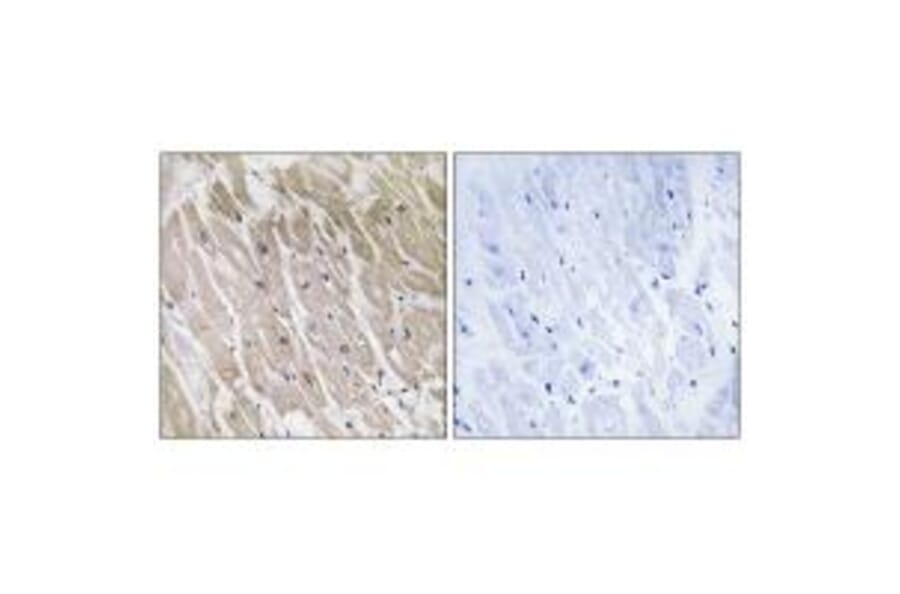 Immunohistochemistry - ACAD10 Antibody from Signalway Antibody (34377) - Antibodies.com