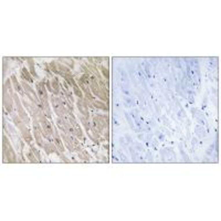 Immunohistochemistry - ACAD10 Antibody from Signalway Antibody (34377) - Antibodies.com