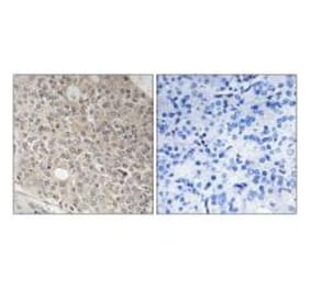 Immunohistochemistry - AMOTL1 Antibody from Signalway Antibody (34421) - Antibodies.com