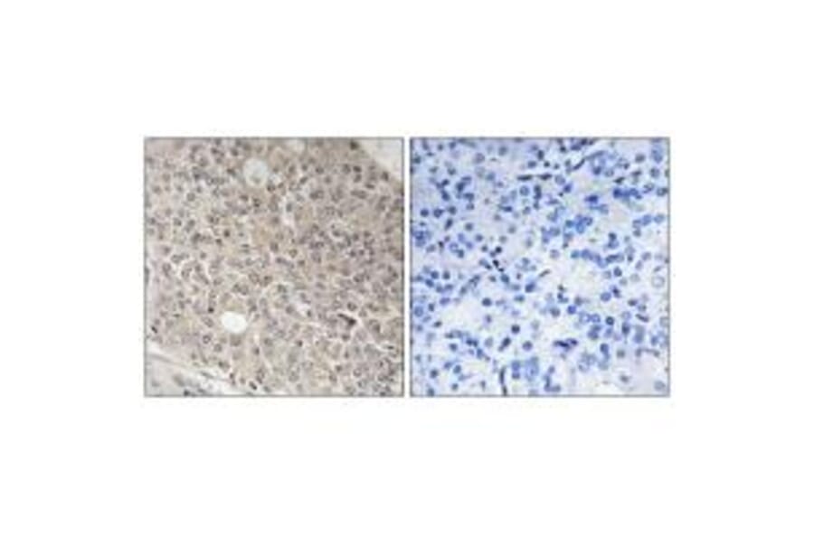 Immunohistochemistry - AMOTL1 Antibody from Signalway Antibody (34421) - Antibodies.com