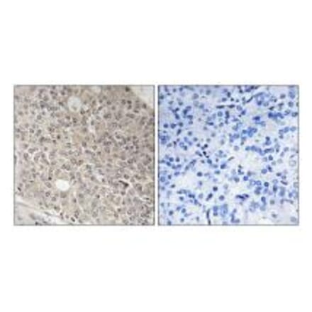 Immunohistochemistry - AMOTL1 Antibody from Signalway Antibody (34421) - Antibodies.com