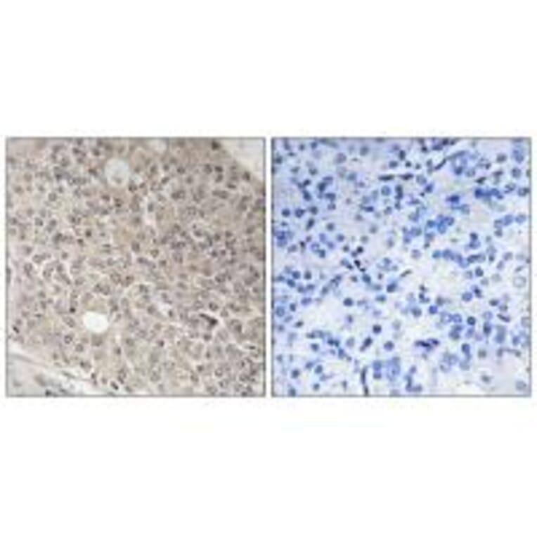 Immunohistochemistry - AMOTL1 Antibody from Signalway Antibody (34421) - Antibodies.com