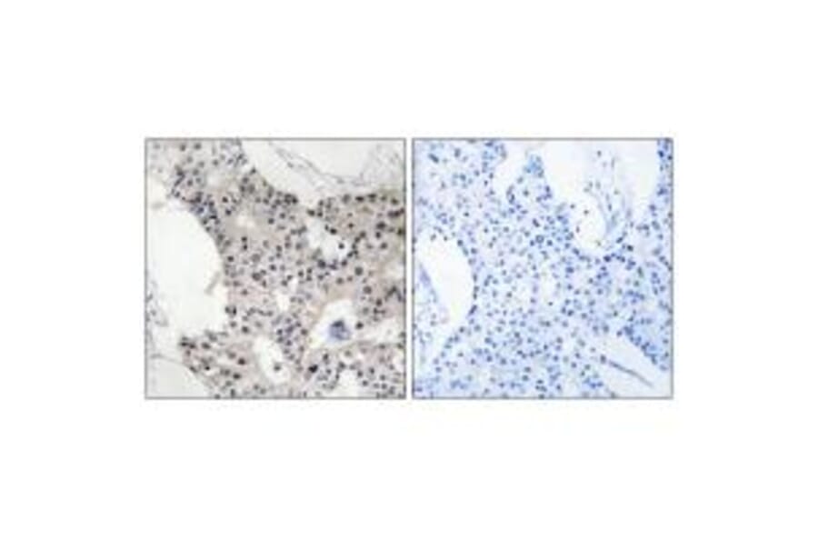 Immunohistochemistry - BAGE4 Antibody from Signalway Antibody (34477) - Antibodies.com