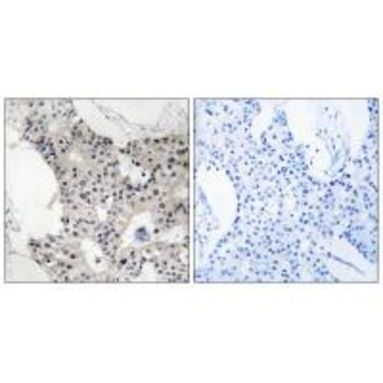 Immunohistochemistry - BAGE4 Antibody from Signalway Antibody (34477) - Antibodies.com
