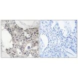 Immunohistochemistry - BAGE4 Antibody from Signalway Antibody (34477) - Antibodies.com
