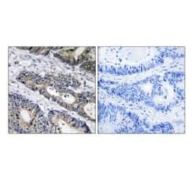 Immunohistochemistry - GLB1L3 Antibody from Signalway Antibody (34495) - Antibodies.com