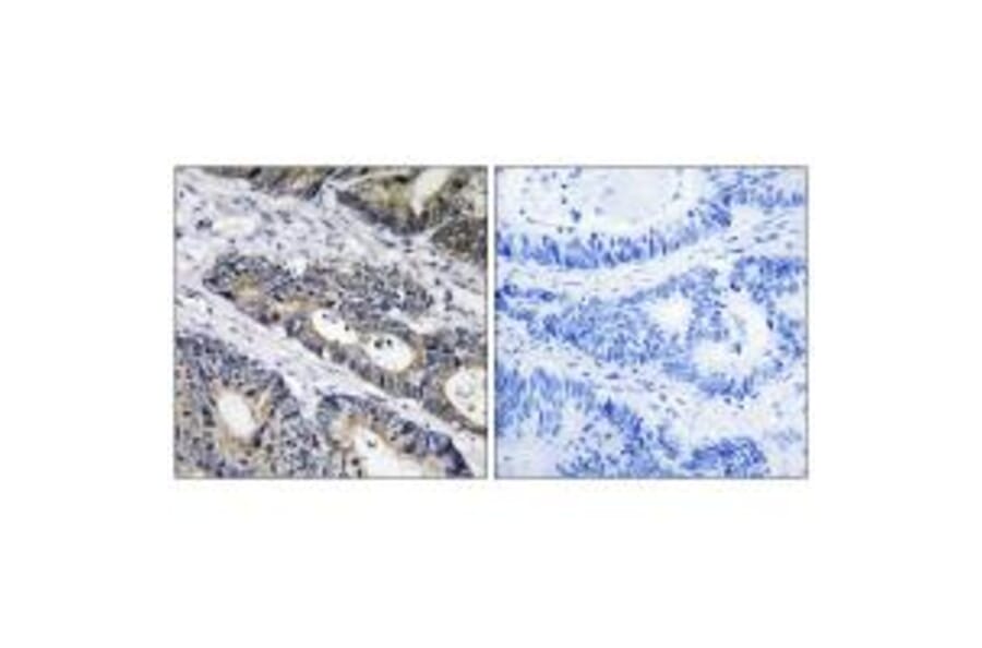 Immunohistochemistry - GLB1L3 Antibody from Signalway Antibody (34495) - Antibodies.com