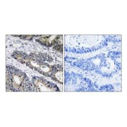 Immunohistochemistry - GLB1L3 Antibody from Signalway Antibody (34495) - Antibodies.com